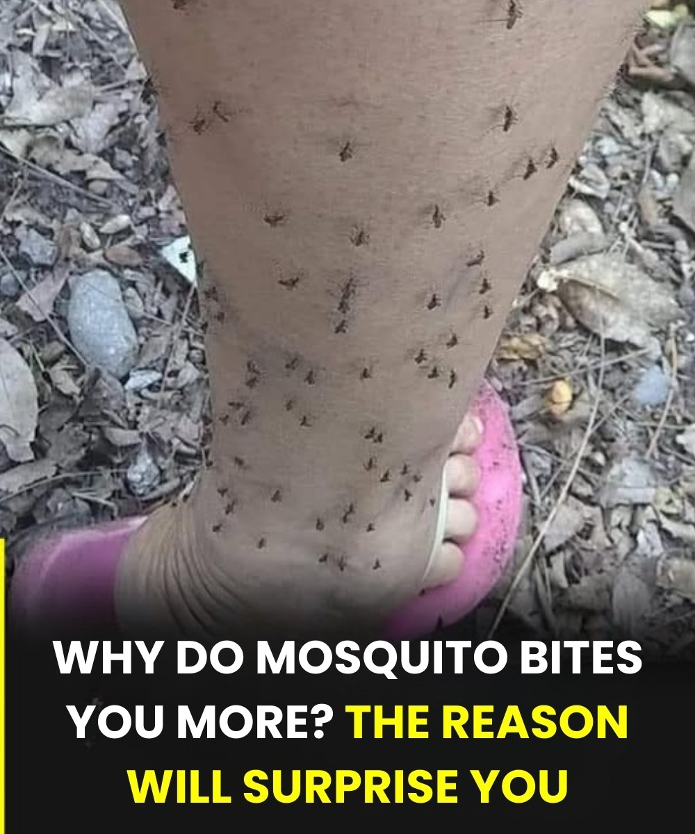 Why do mosquitoes only bi:te you? The reason will surprise you… Read more