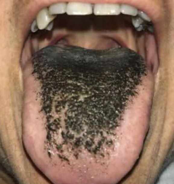 These are the consequences of sleeping with the… See more