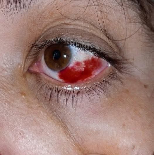 These are the consequences of sleeping with a… See more