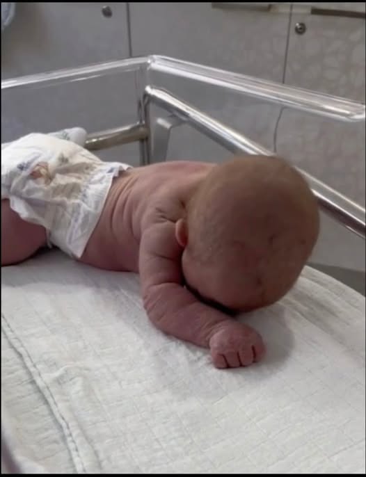 Baby born with an DIU peg… See more