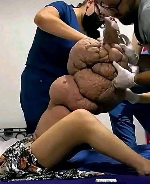 These are the reasons for sleeping with a 1…See more👇