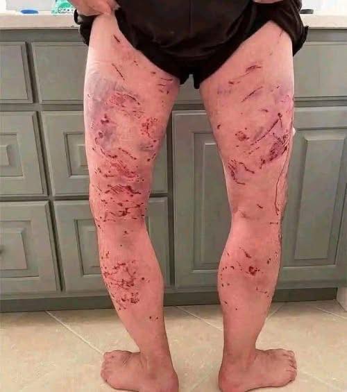 These are the consequences of sleeping with the… See more