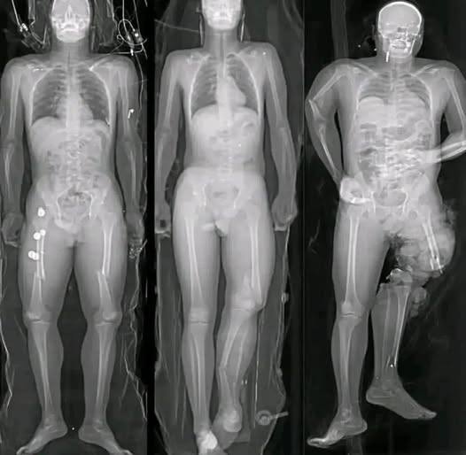 🚨COVID-19. Global alert: Vaccinated individuals discover new cancer…See more