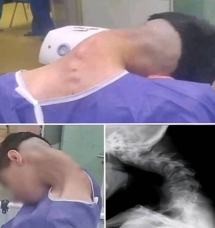 Young man hospitalized because he dropped his ca…See more