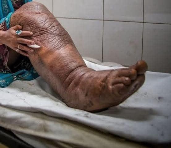 These are the consequences of sleeping with a… See more