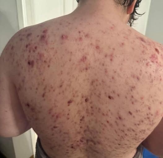 These are the consequences of sleeping with the…See more