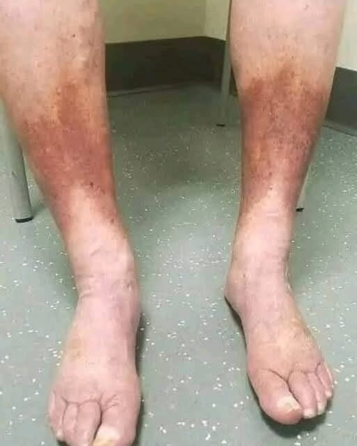 These are clear signs that he is cr… See more