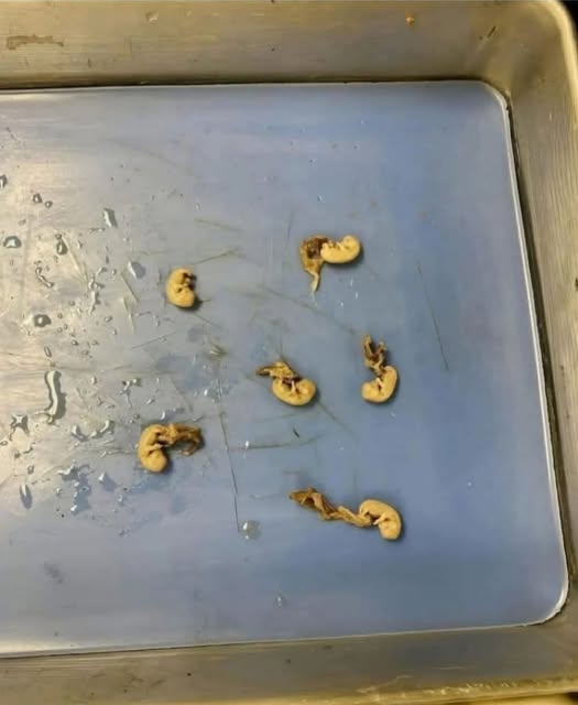 They look like little seeds but they are… See more