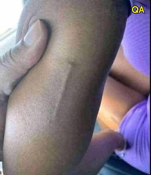 Found this in my girls arm still trying to figure out what it is? 😮😮👇👇