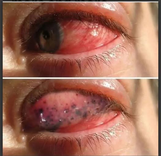 These are the consequences of sleeping with…See more