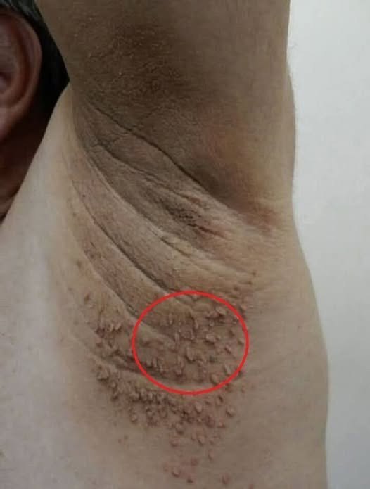 These are the first symptoms of cr,,,See more