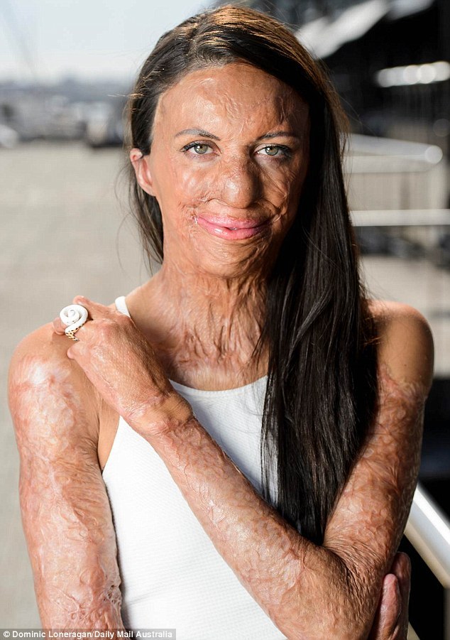 These are the consequences of sleeping with…See more