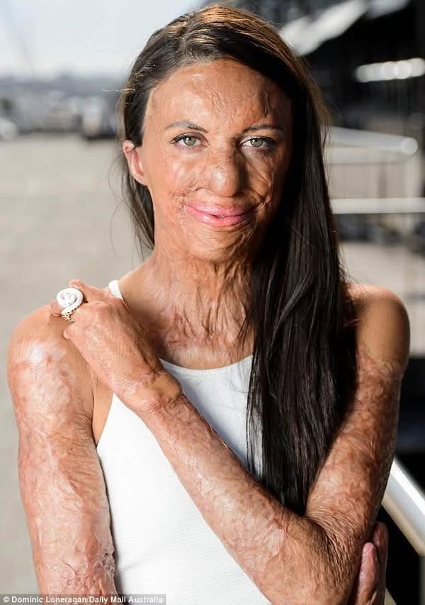 These are the consequences of sleeping with…See more