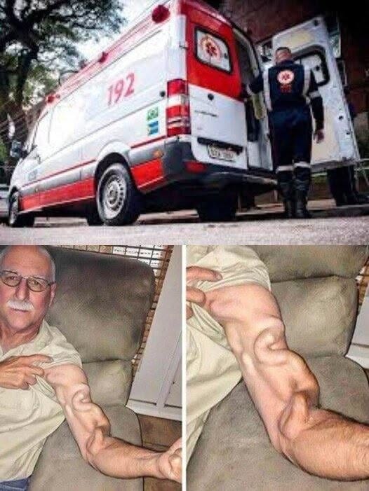 A man goes to bed and ends up feeling a severe pain in his arm, it was a ca… See more