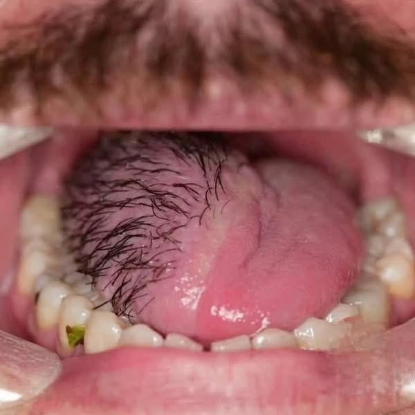 These are the consequences of sleeping with…See more