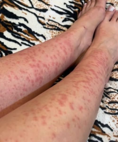 I spent a few nights at my friend’s old place and saw these weird bumps…