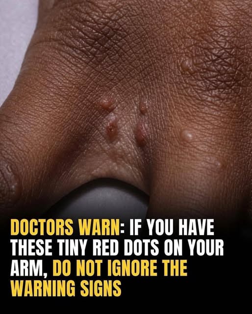 Don’t ignore these small red bumps—they could be your body’s early warning signal.