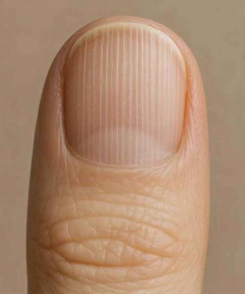 If you have lines on your nails, it means you have ca…See more
