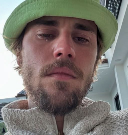 🥺Justin Bieber admits that he tested positive for…See more