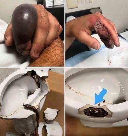 He went to the bathroom without knowing that there was a…See more