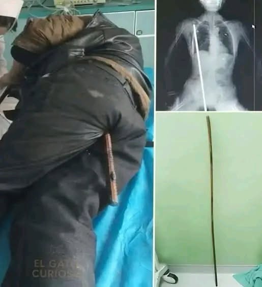 Young man hospitalized after being arrested…See more