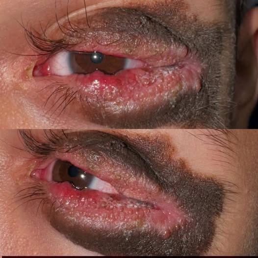 These are the consequences of sleeping with… See more