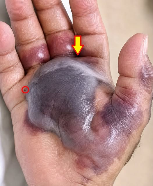 ATTENTION to these first signs of…𝗦𝗲𝗲 𝗺𝗼𝗿𝗲