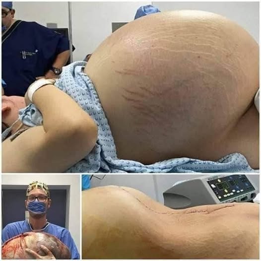 They told her she was pregnant with triplets, but the… See more