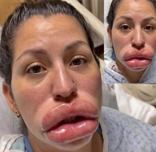 Demanding JUSTICE: Doctor ruined her face and fled… See more